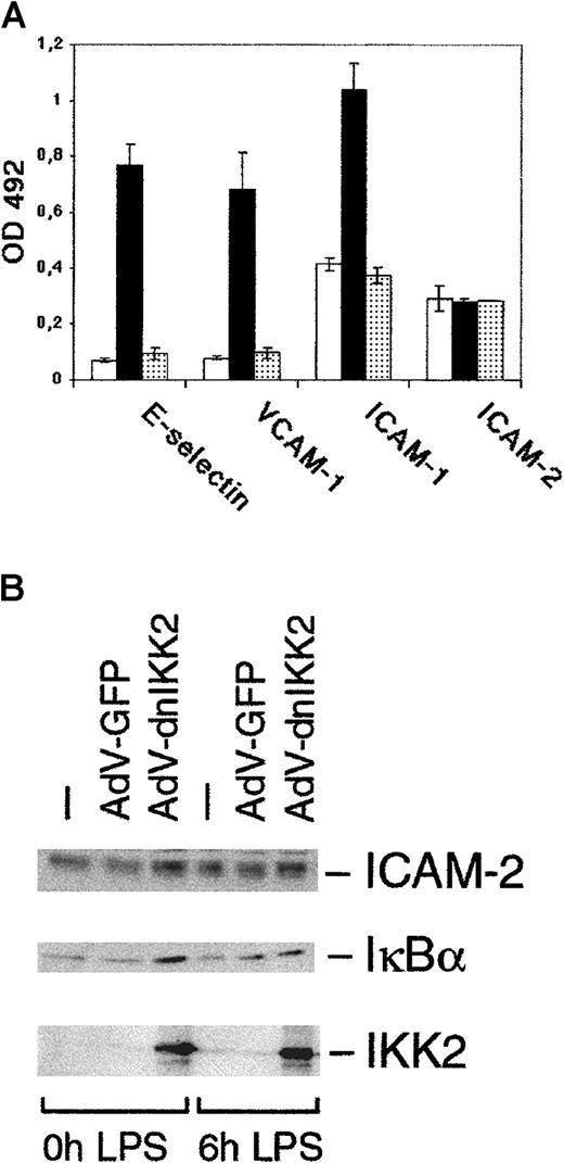 Fig. 4. DnIKK2 inhibits the expression of cell adhesion molecules. / (A) AdV-dnIKK2–transduced (░), AdV-GFP–transduced (▪), or control (■) HUVECs were seeded in 96-well plates. AdV-dn IKK2– and AdV-GFP–transduced cells were stimulated with LPS for 6 hours and control HUVECs were left unstimulated; cells were then analyzed for expression of E-selectin, ICAM-1, VCAM-1, and ICAM-2 using a cell ELISA as described in “Materials and methods.” (B) Western blot analysis of dnIKK2, GFP-expressing, or control HUVECs. Two days after transduction with the respective viruses, cells were stimulated with LPS for 6 hours as indicated and extracts analyzed for expression of ICAM-2, IκBα, and (dn)IKK2. IKK2 was detected with an anti-IKK2 antibody to allow comparison of the levels of transfected and endogenous IKK2.