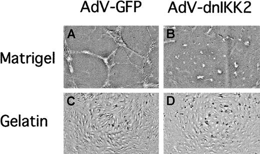 Fig. 7. Expression of dnIKK2 inhibits capillary tube formation. / HUVECs were transduced with either the control virus AdV-GFP (A,C) or with AdV-dnIKK2 (B,D) and after 2 days plated on matrigel (A-B) or gelatin (C-D) as indicated. Pictures were taken 16 hours after plating.