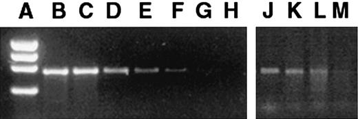 Fig. 1. Presence of retroviral vector marker sequences in bone marrow of mice 6 months after in utero transplantation of transduced FLCs. / Standard dilutions of transduced and nontransduced MPS VII cells were assayed as a standard. (A) φX174 HaeIII marker. (B) 100% transduced cells. (C) 1 in 10 dilution (D) 1 in 102 dilution. (E) 1 in 103 dilution. (F) 1 in 104 dilution. (G) Pure nontransduced cells. (H) H2O control. The PCR bands amplified from the bone marrow of 6-month-old mice that had been transplanted in utero (panels J-M) were compared with the standards. The PCR bands of panels J-L were between reference bands E and F and thus were scored as the lower value of 104, but no band was detected in panel M, which was scored negative.