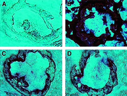 Fig. 3. Expression of human GUSB in bone marrow of C3H mice transplanted in utero with TG FLCs. / Sections of heat-inactivated rib bones (20 ×) from newborn mice. (A) Untreated C3H control. (B) Transgenic control. (C-D) Rib bones from 2 C3H recipients of TG FLCs 8 days after in utero transplantation of TG FLCs.