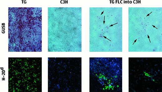 Fig. 4. Presence of TG donor cells in adult C3H recipient spleens after in utero transplantation. / Top row: Spleens stained for the presence of biologically active GUSB (red reaction product) after the C3H GUSB was heat-inactivated. TG indicates transgenic mouse (positive control; 20 ×); B, untreated C3H mouse (negative control; 20 ×); and TG FLCs into C3H, spleens of recipients of nonenriched TG FLCs 2 months after transplantation (20 ×). The arrows point to the areas of cells expressing enzymatically active human GUSB. Bottom row: Immunofluorescent-labeled antibodies against H-2Dd to detect TG donor cells in the recipient spleens. TG indicates transgenic mouse (positive control; 20 ×); C3H, untreated C3H mouse (negative control; 20 ×); and TG FLCs into C3H, transplant recipients with clusters of positive cells (20 ×) and with single, scattered positive donor cells (40 ×).
