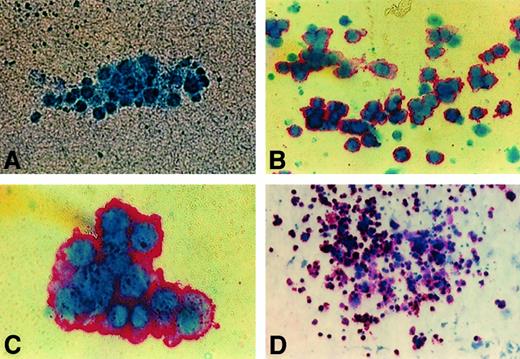 Fig. 6. Immunocytochemistry stain of human GPIIb-IIIa (CD41a) on colonies from NOD/SCID BM. / Representative images of day 10 cultures of human colonies produced by BM cells from NOD/SCID mice transplanted with 0.6 × 106CD34+ PBSCs and killed 4 weeks after transplantation. (A) Negative colony (× 50). (B) Unifocal aggregate of small human CFU-MK (× 50). (C) Intermediate human CFU-MK (× 100). (D) Large human CFU-MK (× 10).
