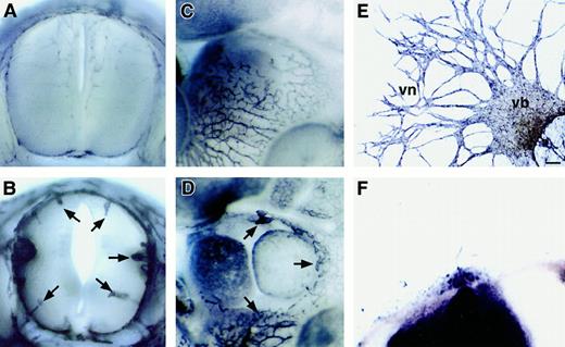 Fig. 1. P-Sp culture system reflects vascular defects in. / np-1 mutant embryos. Spinal cord (A-B) and heart region (C-D) of E12.0 np-1+/+ (A, C) andnp-1−/− (B, D) murine embryos were subjected to immunohistochemical staining with anti–PECAM-1 antibody to visualize all ECs. Capillaries showed little branching and were of large caliber (B, D; arrows). P-Sp explants derived from E9.5 wild-type embryos (E) and mutant embryos (F) were cultured on OP9 stromal cells. Vascular network (vn) formation was defective innp-1−/− P-Sp explants (F), as observed in the CNS and pericardium. The scale bar indicates 100 μm (E-F); vb, vascular bed.