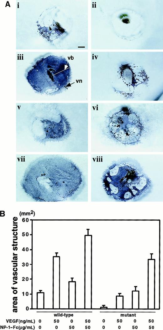 Fig. 5. Synergistic effect of VEGF and dimer of soluble NP-1 in P-Sp cultures. / (A) P-Sp explants derived from E9.5 wild-type and np-1homozygous mutant murine embryo litter mates were cultured on OP9 stromal cells. Formation of the vb and vn was defective in mutant embryo explants (ii) compared with those from wild-type litter mates (i). NP-1–Fc (50 μg/mL), VEGF (50 ng/mL), or both were added to this culture system as described above. The vb was expanded innp-1+/+ embryos on addition of VEGF (iii) or NP-1–Fc (v). Suppressed vasculature in the culture ofnp-1−/− embryos (ii) was partly rescued on addition of 50 ng/mL VEGF (iv) and was completely rescued on addition of 50 μg/mL NP-1–Fc (vi). Simultaneous application of VEGF and NP-1–Fc enhanced the formation of the vb innp-1+/+ (vii) andnp-1−/− (viii) P-Sp cultures. Similar results were obtained in 3 independent experiments. The scale bar indicates 1 mm. (B) The vascular areas shown in Figure 5A were calculated using NIH Image software version 1.62. The mean ± SD vascular areas per explant obtained from 3 independent experiments were as follows: (i) 10.8 ± 1.48 mm2, (ii) 1.1 ± 0.55 mm2, (iii) 35.2 ± 2.39 mm2, (iv) 7.7 ± 1.68 mm2, (v) 18.3 ± 2.48mm2, (vi) 12.1 ± 3.03mm2, (vii) 49.7 ± 3.91 mm2, and (viii) 33.5 ± 3.77 mm2.