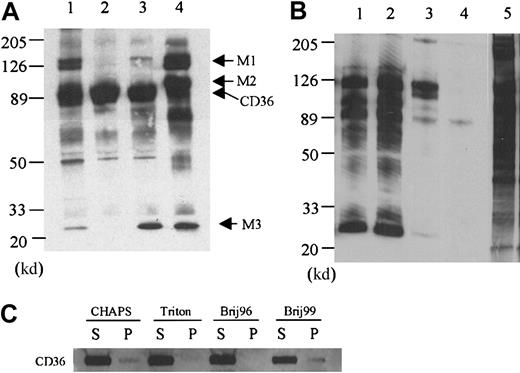 Fig. 1. The effect of detergents on CD36-associated proteins. / (A) Platelet membrane proteins were labeled with biotin and lysed in 1% CHAPS (lane 1), Triton X-100 (lane 2), Brij 96 (lane 3), or Brij 99 (lane 4), and CD36 was immunoprecipitated with the monoclonal antibody FA6-152. In Triton X-100 platelet lysates (lane 2), only CD36 is precipitated, whereas in CHAPS (lane 1), Brij 96 (lane 3), and Brij 99 (lane 4) platelet lysates, additional protein bands can be coprecipitated. (B) Two other anti-CD36 monoclonal antibodies 1E8 (lane 1) and 185-1G2 (lane 2) also precipitate the complex in Brij 99 lysates, but a nonrelated antibody to CD31 (lane 3) and nonimmune mouse IgG (lane 4) do not. Lane 5 is the complete platelet lysate, showing that multiple membrane proteins are biotinylated and the bands that are immunoprecipitated with anti-CD36 antibody are not selectively labeled. (C) The distribution of CD36 in the supernatant (S) or pellet (P) after solubilization in the various detergents. Platelets (5 × 108) were solubilized in 1.0 mL lysis buffer that contained 1% of the various detergents. After 20 minutes at 4°C, the sample was centrifuged, and the supernatant was removed. The pellet was resuspended in one half the original volume of SDS-PAGE sample buffer and 10 μL supernatant or 5 μL solubilized pellet was subjected to Western blot analysis with an anti-CD36 antibody.