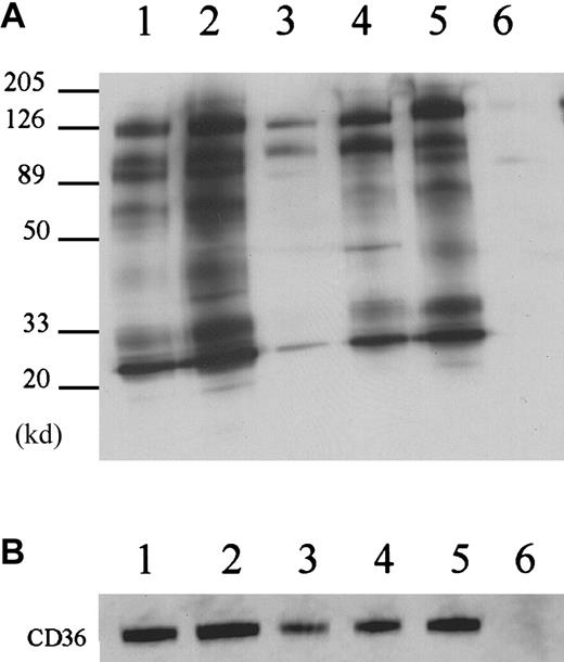 Fig. 3. Reciprocal immunoprecipitations. / (A) The reciprocal immunoprecipitations with anti-CD9 (lane 2), anti-αIIb (lane 3), anti-β3 (lane 4), and anti-α6 (lane5) were compared to nonimmune mouse IgG (lane 6) and anti-CD36 antibody FA6-152 (lane 1). Anti-CD9, β3 and α6 antibodies precipitated similar proteins to the anti-CD36 antibody FA6-152. (B) Immunoprecipitated samples were subjected to Western blot analysis with anti-CD36 antibody. Note that 10 μg anti-αIIb antibody was used in the immunoprecipitation to make the CD36 more readily detectable.