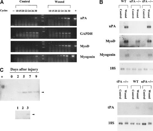 Fig. 1. uPA-deficient mice show a regeneration defect following muscle injury. / (A) uPA expression is increased in regenerating muscle tissue of wild-type (WT) mice after glycerol injury. RNA was isolated from the gastrocnemius muscle group of WT mice (control) or 3 days after glycerol injury (wound). RT-PCR was performed to detect the expression of uPA, GAPDH, MyoD, and myogenin. One tenth of the reaction volume was removed after 10, 15, 20, 22, 24, 26, and 30 amplification cycles. The number of amplification cycles is indicated at the top of each lane. Purified murine cDNAs corresponding to uPA, MyoD, and myogenin were used as positive controls for the PCR reaction (+). Expression of uPA, MyoD, and myogenin increased several times in regenerating muscle compared with control muscle. (B) Impaired up-regulation of MyoD and myogenin mRNAs in skeletal muscle of uPA-deficient mice after freeze-crush injury. RNA was isolated from the musculus tibialis anterior of WT, uPA-deficient, and tPA-deficient mice (control) or 3 days after freeze-crush injury (wound). Northern blot analysis was performed to detect the expression of uPA, MyoD, myogenin and 18S (top) and of tPA and 18S (bottom). Transcript levels of uPA, tPA, MyoD, and myogenin were induced in regenerating muscle of WT mice. Expression of MyoD and myogenin was lower in regenerating muscle of uPA-deficient mice than in regenerating muscle of WT or tPA-deficient mice. As expected, no uPA or tPA mRNA was detected in uPA- or tPA-deficient mice, respectively, whereas levels of 18S were similar in all lanes. (C) Proteolytic activity of uPA is increased in regenerating muscle tissue of WT mice after glycerol injury. Gel zymographies. Forty micrograms protein from muscle extracts of noninjured (0 days after injury) and injured skeletal muscle (2, 5, 7, and 9 days after injury) was analyzed, after SDS-PAGE, by PA zymography (top). Two nanograms purified human uPA (55 kd) was used as a standard (+). Forty micrograms protein from muscle extracts of noninjured (lane 1) and 5-day injured skeletal muscle (lane 2) of uPA-deficient mice and from 2-day injured muscle of WT mice (lane 3) was analyzed by PA zymography (bottom). The approximately 45-kd molecular mass species, indicated by an arrow, corresponds to murine uPA and was calculated according to standard molecular mass markers electrophoresed in an adjacent lane and stained with Coomassie blue. Photographs were taken after overnight incubation at 4°C and 4 hours at 37°C.