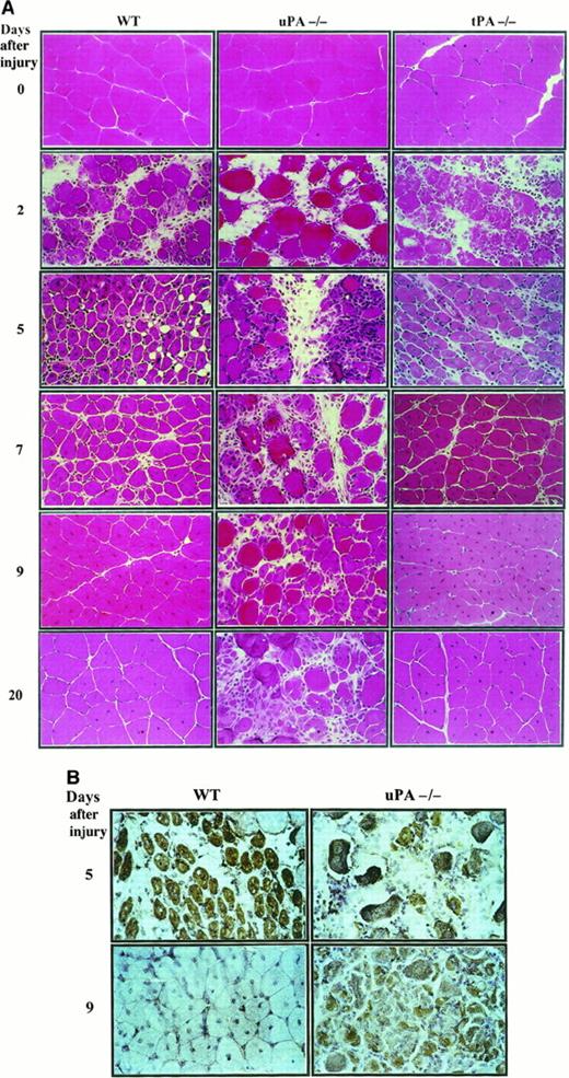 Fig. 2. (A) Glycerol-induced injuries result in impaired skeletal muscle regeneration of uPA- but not tPA-deficient mice. Frozen sections of muscles from wild-type (WT), uPA-deficient, and tPA-deficient mice were stained with H&E 2, 5, 7, 9, and 20 days after injury, as indicated. Contralateral control muscles were also stained with HE (0 days after injury). In WT and tPA-deficient mice, well-advanced regeneration is visible after 5 days, and regeneration is complete after 9 days. In uPA-deficient mice, a regeneration defect is already visible 5 days after injury but is most striking at 9 and 20 days. In WT and tPA-deficient mice, virtually no sign of the previous injury was detectable after 20 days, except for the centrally located myonuclei. Original magnification, 400 ×. (B) Persistence of developmental MHC-positive myofibers 9 days after glycerol injury in uPA-deficient mice. Cryostat frozen sections from WT and uPA-deficient mice were reacted with a monoclonal antibody against developmental MHC (MHCd) at 5 and 9 days after injury, as indicated in the figure (5 and 9 days after injury). Large numbers of MHCd-expressing myofibers are visible in regenerating muscle of uPA-deficient mice 5 and 9 days after intramuscular glycerol injection. In WT mice, fibers positive for MHCd are observed 5 days after injury, whereas no MHCd expression is detected 9 days after injury.