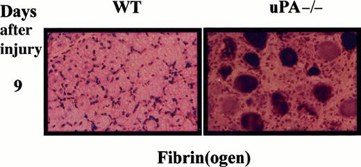 Fig. 5. Immunologic detection of fibrin in regenerating muscle of uPA-deficient mice. / Frozen cross-sections from regenerating muscle (9 days after injury) of wild-type (WT) mice and uPA-deficient mice (uPA−/−) were stained with a rabbit antimurine fibrin(ogen) antibody. Brown indicates positivity. Immunoperoxidase staining showed that fibrin deposits were abundant in uPA-deficient mice, but not in WT mice, at 9 days after injury. Original magnification, 400 ×.