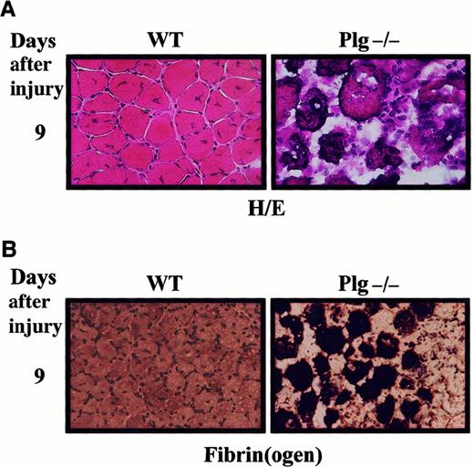 Fig. 8. Glycerol-induced injury results in impaired skeletal muscle regeneration of plasminogen-deficient mice. / (A) Frozen muscle sections from wild-type (WT) and Plg-deficient mice were stained with H&E 9 days after injury. In WT mice, regeneration is almost complete 9 days after injury, whereas it is impaired in Plg-deficient mice. (B) Immunohistochemical detection of fibrin in regenerating muscle of Plg-deficient mice. Sections from 9-day–injured muscles of WT and Plg-deficient mice were stained with a rabbit antimurine fibrin(ogen) antibody and counterstained with hematoxylin. Fibrin deposits were observed in regenerating muscle of Plg-deficient mice but not of WT mice. Original magnification, 400 ×.