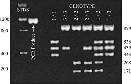 Fig. 1. Distinction of α2 alleles A1, A2, and A3 by RFLP. / A 1332-nucleotide-long segment of intron G4 was amplified by PCR reaction (PCR product) as described in “Patients, materials, and methods.” Complete digestion of this DNA product with a combination of BglII and AseI permits the unambiguous identification of donor genotype with respect to alleles A1, A2, and A3. The expected mobilities of molecular weight standards (STDS) are indicated to the left of the gel. The size of expected digestion products are indicated to the right of the gel. Reaction products were separated on a 2% agarose gel and visualized with ethidium bromide. Digestion patterns for each possible genotype are represented.