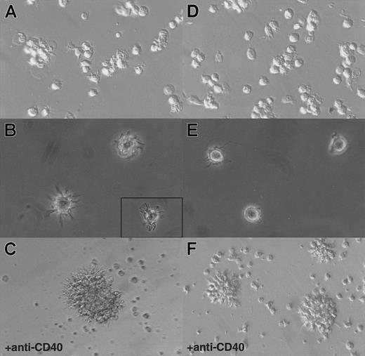 Fig. 4. Morphology of CD11b− and CD11b+DCs freshly after sorting or after 24 hours of CD40 activation in culture. / (A) CD11b− DCs exhibit dendrites immediately on isolation and rapidly cluster. (B) A closer view shows that CD11b−DCs display a typical dendritic morphology. (C) After CD40 activation, CD11b− DCs form large, tight clusters of cells displaying long dendrites. (D) (E) Freshly isolated CD11b+ DCs do not adhere to glass or plastic and display a “hairy” morphology. (F) After CD40 activation, CD11b+ DCs form small clusters of cells exhibiting dendrites. Original magnification: 20 × (panels A, D, C, and F); 40 × (panels B and E).