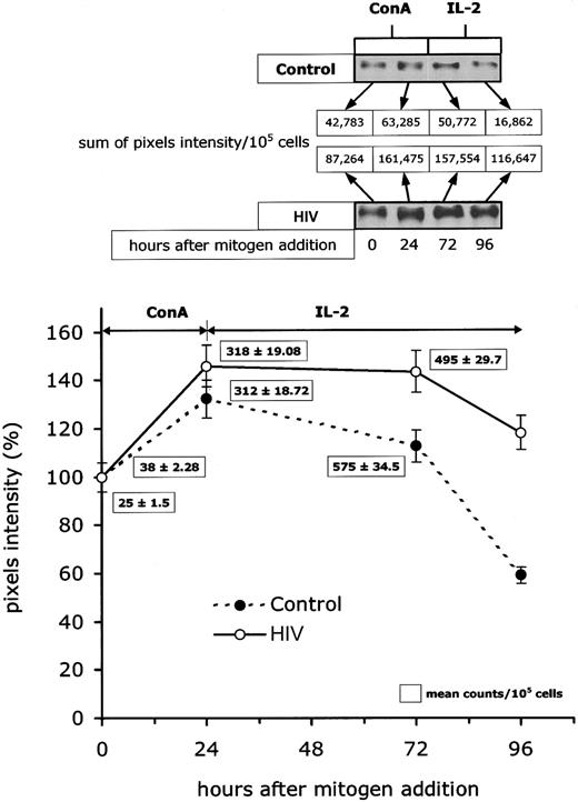 Fig. 3. Intracellular turnover of cyclin B1 in lymphocytes from HIV-infected patients. / Kinetic analysis of intracellular concentration of cyclin B1 (expressed as percentage of the baseline pixel intensity) on in vitro mitogen activation was performed in peripheral blood lymphocytes from 20 HIV-infected patients and 20 controls. The top panel reports Western blots from selected experiments in which the cyclin B1 overtime cellular expression was sequentially studied after lymphocyte activation. The curve in the bottom panel describes results of a representative experiment in which sequential cyclin B expression in one HIV-infected patient and one control were analyzed in the same Western blot experiment (3 measurements per patient per time point). The numeric results in the box represent the mean levels of initial cyclin B synthesis as studied at time 0, 24, and 72 hours after activation in the same representative experiment.
