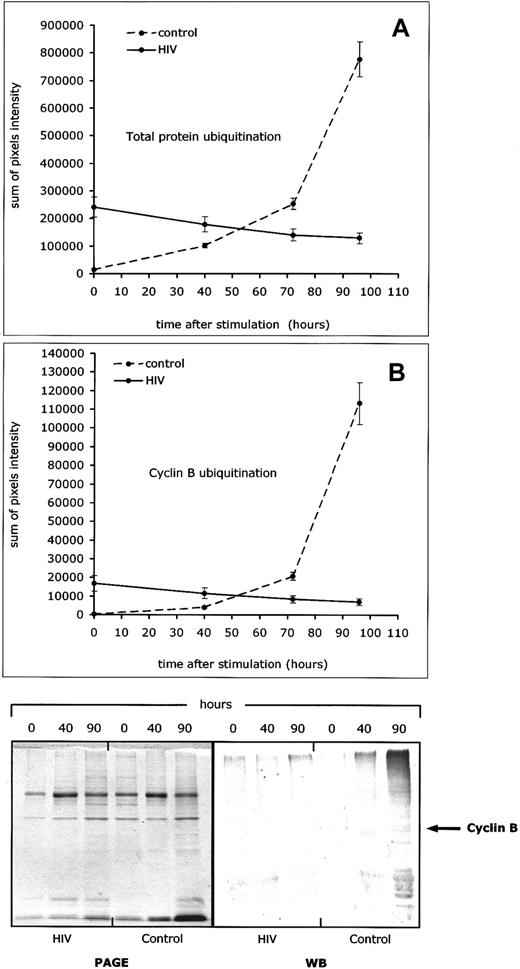 Fig. 5. Defective cyclin B1- and total protein-ubiquitination in lymphocytes from HIV-infected patients. / Protein and cyclin B ubiquitination were studied after in vitro activation (ConA + IL-2) of peripheral blood lymphocytes from 20 HIV-infected patients and 20 controls, and measured at different time points (0, 40, 70, and 90 hours). (A) Level of total protein ubiquitination. (B) Level of cyclin B1 ubiquitination. Both curves show results of a representative experiment in which sequential cyclin B and protein ubiquitination in lymphocytes from one HIV-infected patient and one control were analyzed in the same Western blot experiment (3 measurements per patient per time point). The bottom part of the figure shows pictures of 2 representative gels, one for total protein ubiquitination and one for cyclin B ubiquitination, as sequentially determined at 40 and 90 hours after activation in one HIV-infected patient and one control.
