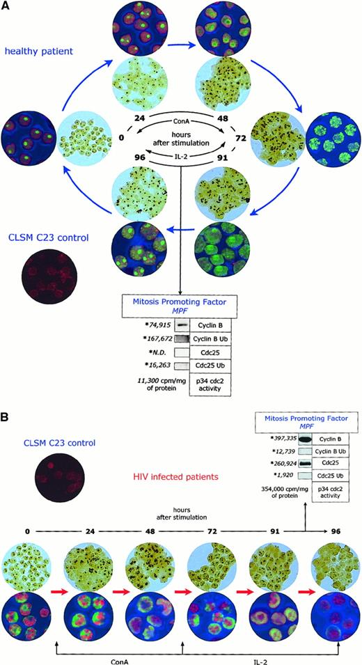 Fig. 6. Abnormal intracellular kinetics of cell-cycle–dependent proteins in lymphocytes from HIV- infected patients. / AgNOR pattern and C23/nucleolin subcellular localization after in vitro activation of lymphocytes from healthy controls (panel A) and HIV-infected individuals (panel B). The indexes of the functional status of the maturation promoting factor (cyclin B expression and ubiquitination, cdc25 expression and ubiquitination, and p34 cdc2 activity) are relative to time 90 to 96 hours after activation.