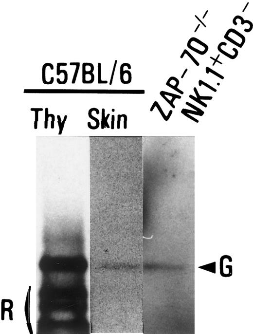 Fig. 8. Gene rearrangement on TCRβ loci in NK1.1+TCRαβ− thymocytes. / A PCR was performed with genomic DNA from B6 thymocytes (Thy; left lane), B6 ear skin (middle lane), or the NK1.1+CD3− thymocytes of ZAP-70−/− mice (right lane) with a primer pair of a coding region of Dβ2 (Dβ2-5′) and 3′-downstream region of Jβ2.7 (Jβ2-3′) to detect rearrangements of Dβ2 to Jβ2 cluster as described in “Materials and methods.” Germline bands (G) and a rearranged band (R) are indicated.