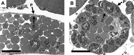 Fig. 4. Electron micrographs of IL-1β–activated venules from PECAM-1–deficient and wild-type animals. / Following in vivo quantification of leukocyte responses 4 hours after intrascrotal administration of IL-1β, cremaster muscles were removed and prepared for transmission electron microscopy. Representative electron micrographs of cremasteric venules from wild-type (A) and PECAM-1–deficient (B) mice are shown. E indicates endothelium; N, neutrophil; P, pericyte and associated perivascular basement membrane. Bar represents 10 microns.