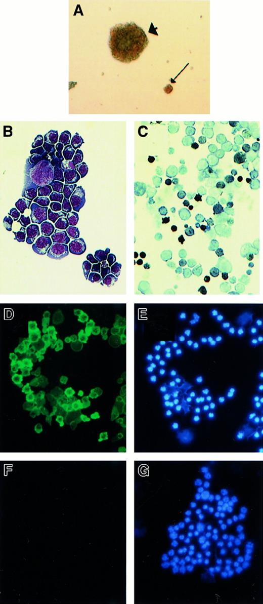 Fig. 1. Characterization of immortalized EKLF−/−cell lines. / (A) Appearance of transduced EKLF−/− colonies in methylcellulose after 5 days of culture in Epo (2 U/mL). Typical colony-forming unit–erythroid and a large erythroid colony are indicated by arrow and arrowhead, respectively (magnification × 40). (B-E) Cytocentrifuge specimens of the EKLF−/− cell line B1. (B) May-Grünwald-Giemsa stain showing erythroblast morphologic features. (C) Stain for hemoglobin usingo-dianisidine and Harris hematoxylin as counterstain. (D) Expression of human γ-globin by direct immunofluorescence with an FITC-conjugated antibody raised against hemoglobin F. (E) The same field as in panel D but photographed after UV excitation to demonstrate blue nuclear fluorescence (DAPI). (F,G) Cytocentrifuge specimens of a negative control cell line, J2E, which contains no human DNA sequences and shows no detectable γ-globin. The slide was treated as described for panels C and 1D.