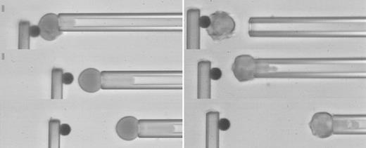 Fig. 2. Tether formation. / Video micrographs show tether formation from a marrow reticulocyte (left column) and a normoblast (right column). The top images show the cell morphology and the resting position of the cantilever. As the cells are withdrawn, the cantilever deflects, providing a measure of the force (middle panels). When the force gets big enough, the surface yields, and a strand of membrane is pulled out between the cell and its attachment site on the bead. After a length of 10 to 30 μm is reached, the cell is held stationary and the force on the tether is allowed to relax to a steady value (bottom panels).