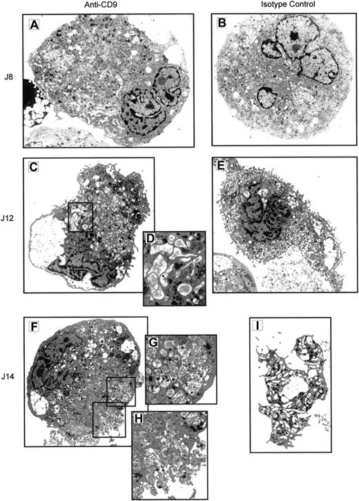 Fig. 7. Antibody ligation of CD9 alters the membrane structure and terminal maturation of MK cells in culture. / CD34+ cells were cultured for 14 days under MK conditions in the presence of CD9 mAb (A, C, D, F, G, H) or of isotype control (B, E, I) At different time-points (days 8, 12, 14), cells were harvested and analyzed by electron microscopy for ultrastructure. Isotype control cells displayed typical ultrastructural features of MKs: multilobed and indented nucleus (B), a well-developed and aligned demarcation membrane system (B, E), multivesicular bodies, numerous specific MK granules, formation (E), and shedding of proplatelets (I). CD9 mAb-treated cells also exhibited a multilobed and indented nucleus, but they showed major cytoplasmic abnormalities: demarcation membrane system heterogeneously distributed throughout the cytoplasm (A), some open cisternae containing a fibrillar material (D), numerous heterogenous multivesicular bodies (A, C, F, G), large vacuoles probably resulting from multivesicular body fusions (G), and exocytosis of the vacuolar content (H). Magnifications: × 2400 for C, E, F, I; × 3000 for A, B; × 6000 for D, G, H.