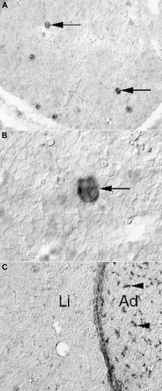Fig. 5. Limited expression of PDGF-B and PDGFRβ in E14.5 fetal mouse livers. / Nonradioactive in situ hybridization shows PDGF-B expression in a subset of liver cells (A, arrows), which have the morphologic hallmarks of megakaryocytes (B, arrow). PDGFRβ expression is low in the liver (C, Li), in comparison with the adjacent adrenal (C, Ad), in which abundant positive cells with perivascular location are seen (arrowheads). The developing hepatic connective tissue capsule expresses PDGFRβ, as shown in the homogeneous layer of stained cells between the liver tissue and the adrenal.