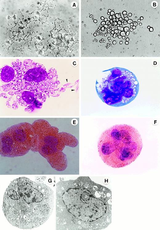 Fig. 1. Morphology of megakaryocytes in primitive- and adult-type Mk colonies. / In situ appearance of megakaryocyte colonies cultured from 7.5-dpc YS cells for 3 days (A) (original magnification × 300) and cultured from adult BM cells for 5 days (B) (original magnification × 200) in the presence of SCF, IL-3, IL-6, G-CSF, EPO, and TPO. Appearance of megakaryocytes stained with May-Grunwald Giemsa (C, D; the arrowheads show the proplatelets) and AchE (E,F) in megakaryocyte colonies at day 3 of culture of 7.5 dpc YS cells (C,E) and at day 5 of culture of adult BM cells (D,F) (original magnification × 1000). Ultrastructure of megakaryocytes in megakaryocyte colonies at day 3 of culture of 7.5-dpc YS cells (G) (original magnification × 3200) and at day 5 of culture of adult BM cells (H) (original magnification × 7000).
