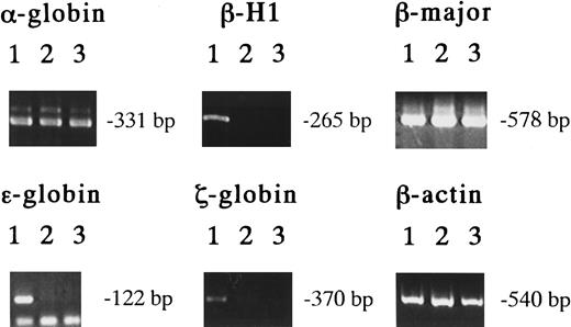 Fig. 4. Hemoglobin expression in various EMk or Mk-Mix colonies. / Detection of hemoglobin expression by RT-PCR analysis on individual EMk or Mk-Mix colonies from 8.5 dpc YS (lane 1), 13.5 dpc FL (lane 2), and adult BM cells (lane 3).
