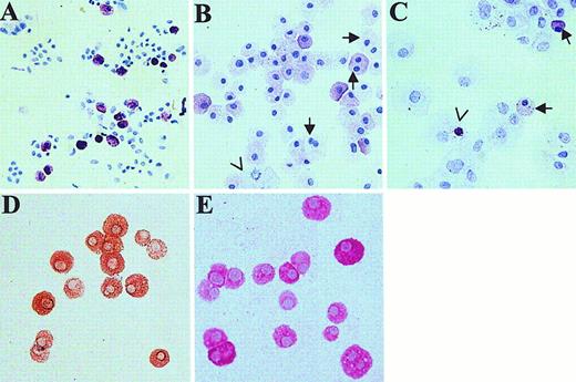 Fig. 2. Light microscopic appearance of cytospins of skin-derived mast cells. / Toluidine blue staining dispersed skin cells at the initiation of culture (A) and after 4 weeks of culture in AIM-V (B) and in RPMI 1640 with 10% CPSR-3 (C) as described. In panel B, arrows show 2 cells with dual nuclei; an arrowhead points out a mitotic cell. In panel C, arrows point to mast cells (17% of total cells counted on this slide); the arrowhead shows a metachromatic body inside a nonmast cell. Cells grown for 4 weeks in AIM-V medium (98% mast cells) were stained for chymase (D) and tryptase (E). Essentially all cells contained both chymase and tryptase. The original magnification of all photomicrographs was × 200.