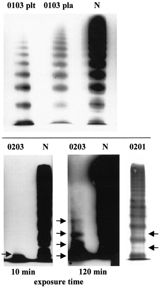 Fig. 1. Multimer analysis of vWF in patient 0103 with vWD 2A/IIE and patient 0203 with vWD 3. / (Top) Characteristic for vWD 2A/IIE are the lack of HMWM, the lack of a triplet structure (indicating decreased proteolysis), and the presence of the defect in both the patient's plasma (pla) and platelets (plt). (Bottom) Multimer analysis of vWF derived from platelets from the patient with vWD 3 (0203) compared with a normal (N) control. Bands corresponding to low-molecular-weight vWF (arrows) appeared only after prolonged exposure of the film, indicating a very low concentration of vWF. The 0201 indicates vWF multimer pattern of the heterozygous father's plasma. Arrows point to extra intervening bands between triplets.