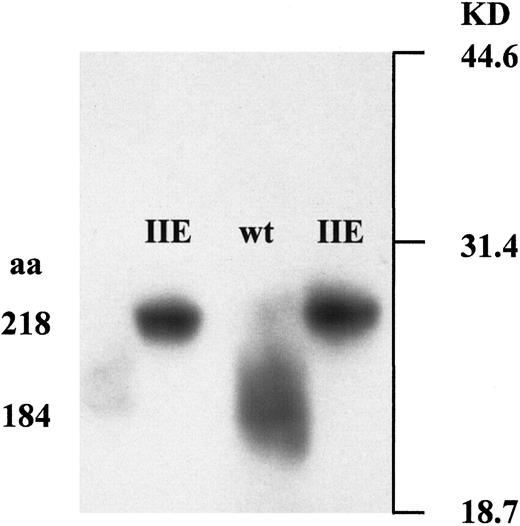 Fig. 3. Protein truncation assay. / In vitro expression of the 3′ fragments of the normal and the mutant vWF gene demonstrated an elongated translation product of 218 amino acids that was caused by the vWD 2A/IIE frameshift mutation 8566delC.