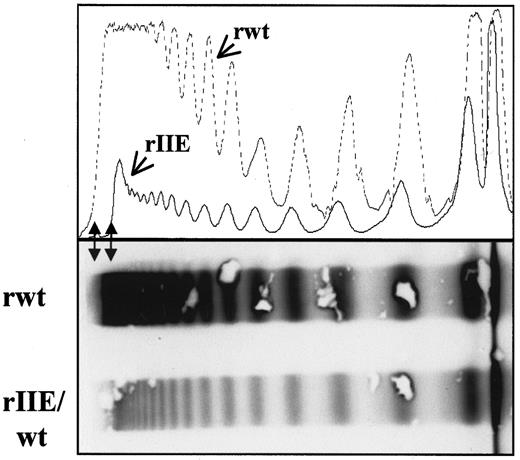 Fig. 7. Densitometric evaluation of the multimer pattern of recombinant vWF. / Recombinant WT vWF was compared with the product from the coexpression of WT and 2A/IIE vWF in the proportion of 1:39. Ultralarge multimers were absent (arrows), and there was a relative decrease in large multimers in the multimer pattern of the coexpressed vWF.