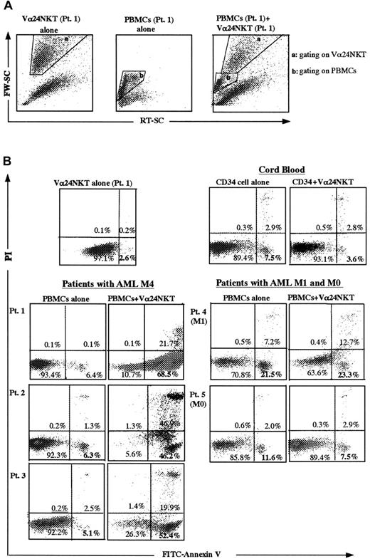 Fig. 3. Apoptotic cell death of PBMCs from AML patients and cord blood CD34+ cells following coculture with activated CD4+Vα24NKT cells derived from Pt 1. / Target cells were gated for the PBMCs from Pt 1 based on the forward light scatter (FW-SC) and the side light scatter (RT-SC) (A). A similar gating procedure was used for assays using the other targets. Early apoptotic cells are defined by the AV+PI−population in the dot plots for FITC-AV binding (FL 1 channel) and PI uptake (FL2 channel) (B). The data shown represent 1 of 3 experiments with similar results.