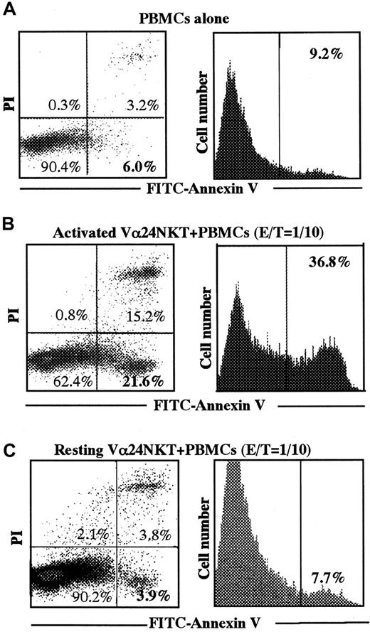 Fig. 6. Apoptosis of AML M4 blasts in NOD SCID mice after adoptive transfer of activated CD4+Vα24NKT cells. / PBMCs from Pt 1 (AML M4) were intraperitoneally injected into 6 mice at 5 × 105 cells/mouse. On day 5 after PBMC injection, 5 × 104 CD4+Vα24NKT cells/mouse were intraperitoneally inoculated into 3 of the 6 mice. Mice were killed 24 hours after inoculation of the CD4+Vα24NKT cells, and peritoneal cells were harvested from each mouse. Apoptosis of AML PBMCs from Pt 1 in the peritoneal cells was assessed as described in Figure3. Apoptosis of PBMCs when only the PBMCs were injected into NOD SCID mice (A). Apoptosis of the PBMCs when activated CD4+Vα24NKT cells (B) or resting CD4+Vα24NKT cells (C) were transferred. The data are representative of 3 experiments with similar results.