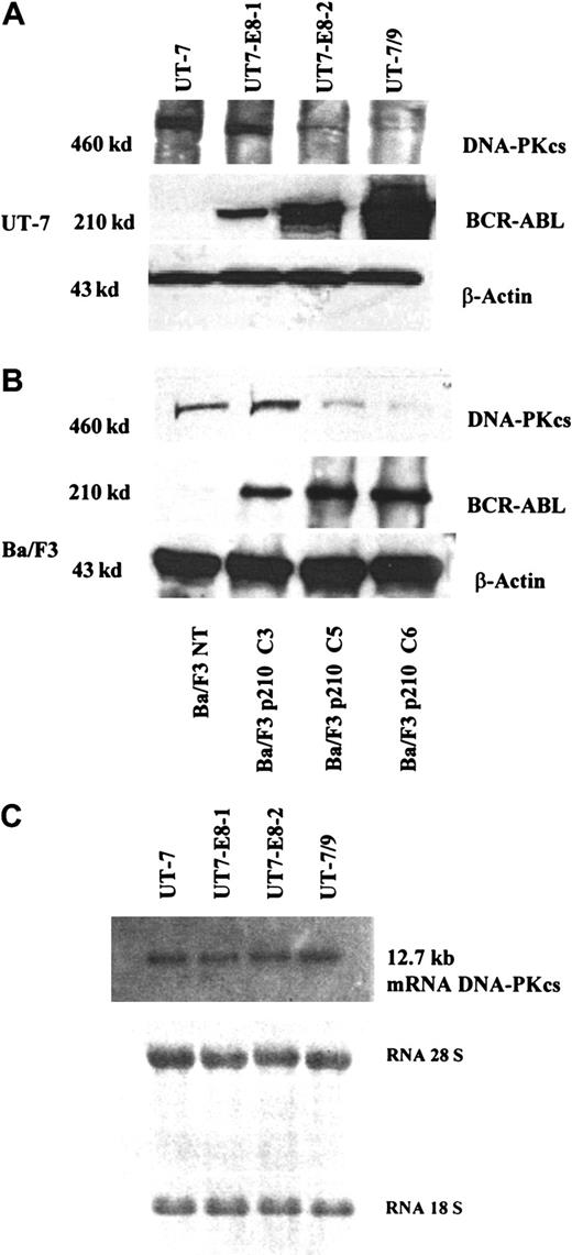 Fig. 1. Western blot analysis showing DNA-PKcs and BCR-ABL expression in the human UT-7 clones, expressing variable levels of BCR-ABL. / (A) Western blot analysis showing DNA-PKcs and BCR-ABL expression in the murine Ba/F3 (B) clones, expressing increasing level of BCR-ABL (C3, low; C5, intermediate; C6, high, as previously reported12). This figure, showing a decreased expression of DNA-PK as BCR-ABL increases, is representative of 3 independent experiments. (C) Northern blot analysis showing the levels of DNA-PKcs mRNA in human UT-7 clones.