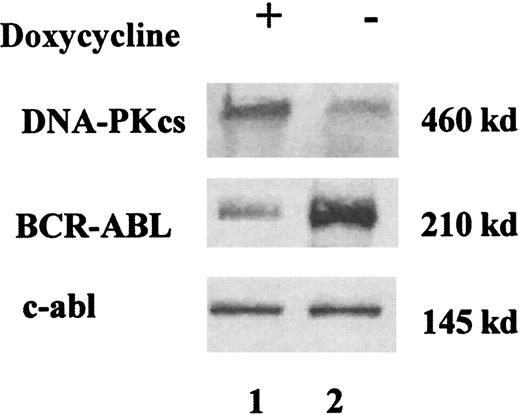 Fig. 2. A representative Western blot analysis showing DNA-PKcs and BCR-ABL expressions in doxycycline-inducible Ba/F3 cell line. / Cells were grown in IL-3 (10% WEHI), with (+, lane 1) and without (−, lane 2) doxycycline (1 μg/mL) for 48 hours. Cells extracts were immunoblotted with anti-DNA-PKcs and anti-BCR-ABL antibodies. Equal protein loading was assessed by protein dosage, Ponceau staining, and the presence of an equal intensity of the endogenous c-abl. When the cells were deprived of tetracycline for 48 hours, a marked increase of BCR-ABL expression was found, along with a reduction of DNA-PKcs expression.