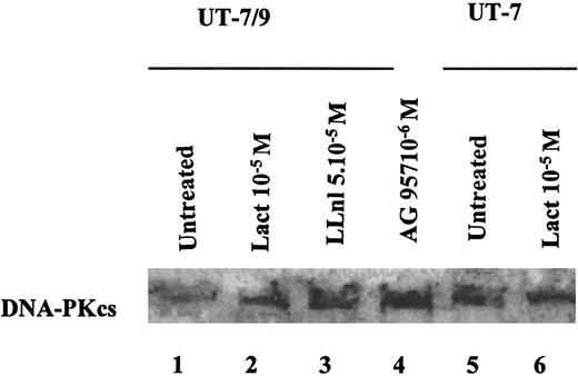 Fig. 3. Representative Western blot, showing the effects of BCR-ABL TK inhibition and proteasome inhibition on DNA-PKcs expression in UT-7/9 BCR-ABL expressing cells and parental UT-7 cells. / Cells were grown in rhGM-CSF and exposed to tyrphostin AG957 1 μM for 3 hours (lane 4), proteasome inhibitors lactacystin (10 μM; lanes 2 and 6) and LLnl (50 μM; 8 hours' incubation; lane 3) diluted in DMSO, similar volume of DMSO was added for 8 hours as a control (lanes 1 and 5). The DNA-PKcs protein levels could be increased using both TK and proteasome inhibitors.