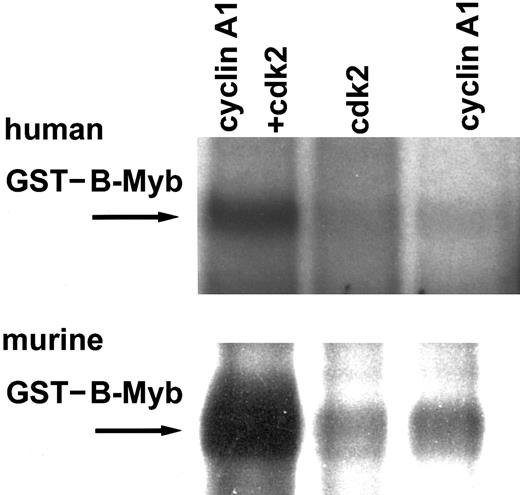 Fig. 1. In vitro kinase assay for human GST–B-myb (full length) and murine GST–B-myb (aa 225-705). / GST fusion proteins were phosphorylated in vitro by cyclin A1 and cdk2 expressed in Sf9 lysates using 32P-ATP. Neither cyclin A1 nor cdk2 alone phosphorylated B-myb, but the combination of both led to strong phosphorylation of the murine as well as the human B-myb.