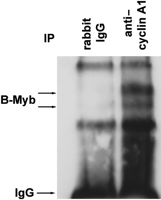 Fig. 4. B-myb co-immunoprecipitates with cyclin A1 in vivo. / U937 leukemic cells were lysed in RIPA buffer, and cyclin A1 was immunoprecipitated with rabbit polyclonal anticyclin A1 antibody. Polyclonal mouse IgG antibody served as a control. The Western blot was probed with anti–B-myb antibody. Besides the IgG band and 2 non-specific bands of similar strength in both lanes, 2 specific bands were seen that represent B-myb in its phosphorylated and non-phosphorylated forms (compare to Figure 7B).16