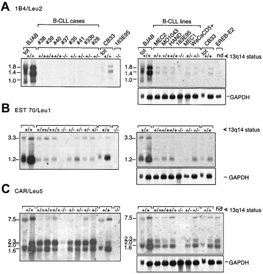 Fig. 2. Expression analysis of the candidate genes in B-CLL. / The 13q14 status of each sample is indicated: +/+, no loss;+/−, monoallelic loss; −/−, biallelic loss; nd, not determined. PolyA+ (or total, tot) RNA derived from B-CLL samples (indicated by the corresponding number) or cell lines was sequentially hybridized with A, 1B4/Leu2-; B,EST70/Leu1-; and C, CAR-specific probes (in this order). The cell lines used include 6 B-CLL-derived cell lines,353940 one B-cell lymphoma-derived line (BJAB), one cord blood-derived line (CB33), and one lymphoblastoid cell line (EREB-E238). The transcript sizes (kb) are indicated. Exposure times are 6 days for the 1B4/Leu2 gene and 2 days for the EST70/Leu1 and CAR genes. The normal retained allele of genes EST70/Leu1 and CAR is expressed in the deleted samples. On the contrary, no expression of the1B4/Leu2 gene is detected in B-CLL tumors, whereas traces of expression were detected in B-CLL-derived cell lines.