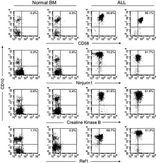 Fig. 2. Expression of CD58, ninjurin1, creatine kinase B, and Ref1 in normal and leukemic immature B cells by flow cytometry. / For each protein, results obtained with 2 normal bone marrow samples and 2 cases of B-lineage ALL are shown. Flow cytometric dot plots illustrate labeling of CD19+ lymphoid cells with antibodies against the tested protein (FITC; x axes) and with anti-CD10 (PE; y axes). Drawing of quadrants was based on staining with isotype-matched fluorochrome–conjugated nonreactive Igs. The percentage of cells in the upper right quadrant is indicated in each plot.