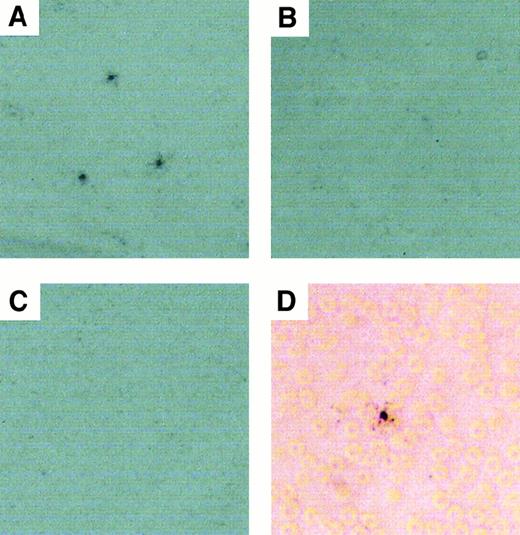 Fig. 3. pLL20/DNA complexes, but not pLL211/DNA, show punctate distribution of radioactivity in blood smears, and both types of complexes bind erythrocytes. / pLL20/DNAct or pLL211/DNAct complexes were administered intravenously to female Balb/c mice (0.1 mL of 10 μg/mL DNA). Blood was sampled from the end of the tail after 1 minute and smeared onto glass slides. Radioactivity in the smear was developed by exposure of the slides to liquid photographic emulsion and viewed by light microscopy. (A) pLL20/DNAct (80 × magnification); (B) pLL211/DNAct (80 × magnification); (C) DNA alone (80 × magnification); (D) pLL20/DNAct (400 × magnification). Similar results were obtained using pLL/DNAcp complexes (data not shown).