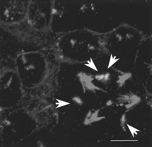 Fig. 1. Correlation between the number of centromeres of chromosome 1 and the cell ploidy. / Human CD34+ cells were grown in the presence of PEG-rhuMGDF and SCF. Day 5 megakaryocytes were treated with the PRINS and immunofluorescence procedure described in “Materials and methods.” They were cytospun, fixed with methanol/acetic acid, and permeabilized with Triton. Centromeres of chromosome 1s were probed in green by PRINS, using specific centromeric primers and FITC-labeled nucleotides. Microtubules were stained in red by indirect immunofluorescence with an anti–β-tubulin antibody, followed by incubation with TRITC-labeled antimouse F(ab′)2 fragments. Slides were examined by confocal microscopy with a 3-dimensional reconstruction and superimposition of the 2 signals. The upper-left corner of the figure shows many diploid interphase cells containing 2 dots representing 2 chromosome 1s; the lower-right corner shows a mitotic polyploid cell that contains a tetrapolar spindle and 4 chromosome 1s (white arrows). Bar, 10 μm.