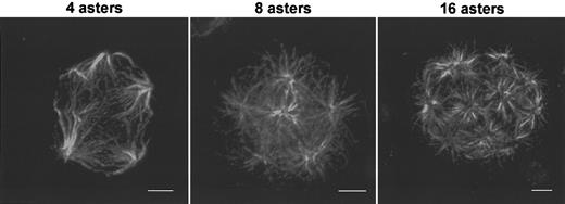 Fig. 6. Structure of multipolar spindle in megakaryocytes. / Human megakaryocytes were obtained as previously described in Figure 1. Spindle immunostaining was performed with mouse antitubulin antibodies followed by incubation with TRITC-conjugated antimouse F(ab′)2 fragments. Endomitotic megakaryocytes with tetrapolar spindle, 8-polar spindle, and 16-polar spindle. Bar, 5 μm.