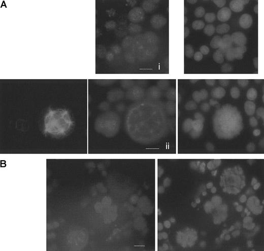 Fig. 7. Studies of hCdh1 and cyclin B1 expression in megakaryocytes. / Immunofluorescence was performed on day 6 megakaryocyte culture as described in Figure 5. (A) HCdh1 immunodetection in human megakaryocytes. (i) Interphase polyploid megakaryocyte shows a nuclear hCdh1 staining, using a polyclonal rabbit antibody followed by donkey TRITC-labeled F(ab′)2 fragments. DNA was counterstained with DAPI. (ii) Double immunostaining of hCdh1 and tubulin with DNA painting. HCdh1 was localized at the spindle poles during endomitosis. Bar 10μm. (B) Timing of cyclin B1 degradation in endomitosis. Cyclin B1 was immunodetected by using a mouse antibody followed by incubation with TRITC-conjugated antimouse F(ab′)2 fragments. DNA was labeled with DAPI. Three sequential phases of endomitosis were observed on a single view: G2/M megakaryocyte in the middle with a strong nuclear staining, prometaphase megakaryocyte in the lower-left corner with cyclin B1 localized at the spindle poles, and anaphase in the upper-right corner in which cyclin B1 is undetectable. Bar, 10 μm.
