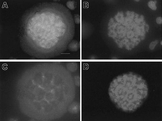 Fig. 8. Immunolocalization of MKLP1 at anaphase. / Double immunostaining was performed on day 6 megakaryocyte culture by using polyclonal goat anti-MKLP1 and mouse antitubulin antibodies followed by incubation with donkey TRITC-conjugated antigoat (C) and FITC-labeled antimouse (D) F(ab′)2 fragments, respectively. DNA was painted with DAPI (B). Panel A shows the merging of the 3 markers. Bar, 10 μm.