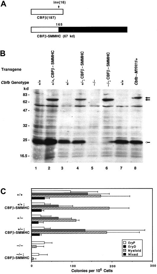 Fig. 3. Ectopically expressed CBFβ-SMMHC does not inhibit definitive hematopoiesis. / (A) Schematic diagram of the wild-type CBFβ(p22) protein and one of the CBFβ-SMMHC proteins generated by the inv(16). (B) Western blot documenting ectopic expression of the 67-kd CBFβ-SMMHC protein in Cbfb+/+, Cbfb+/−, andCbfb−/− ES cells, and expression of the 71-kd CBFβ-SMMHC protein in cells heterozygous for a “knocked-in”CbfbCbfb-MYH11 allele.41 Open arrow indicates the endogenous CBFβ proteins; closed arrows indicate the ectopically expressed CBFβ-SMMHC proteins. (C) Hematopoietic progenitor development in EBs derived from ES cells expressing the CBFβ-SMMHC protein. The Cbfb genotype of the ES cell is indicated, followed by the protein expressed from the transgene. Colony assays were performed on EBs generated from 10 days of primary culture. The mean values (± SD) of total colony numbers in 3 independent experiments are shown. The differences in colony numbers in cells with or without the transgene were not statistically significant.