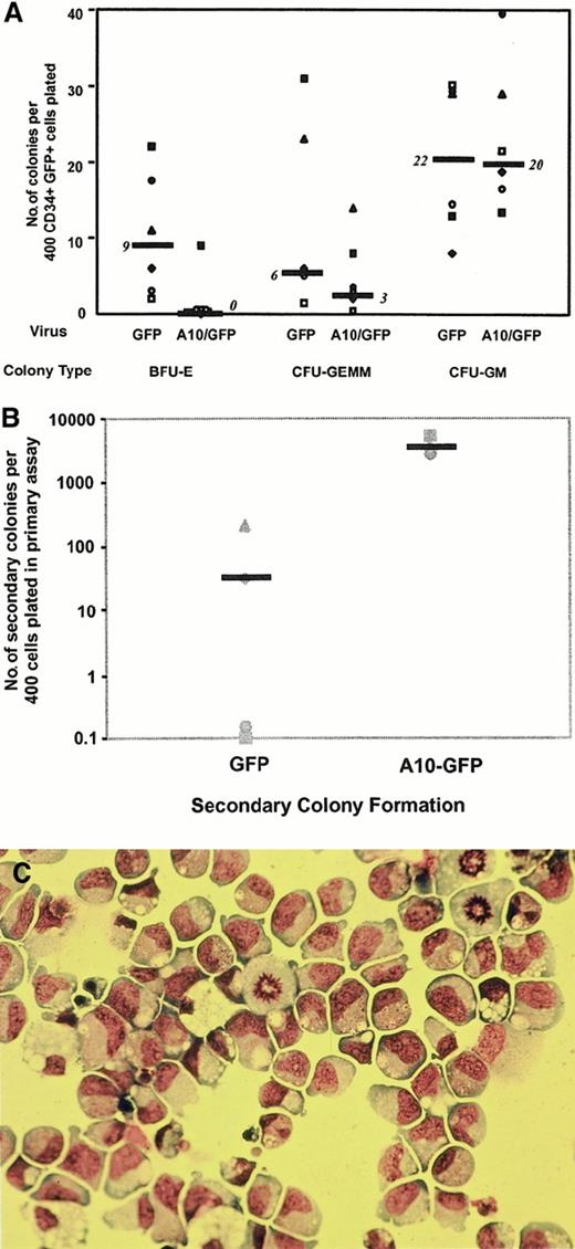 Fig. 3. Colonies derived from A10–GFP- and GFP-transduced progenitors. / (A) Comparison of the frequency and distribution of colonies derived from A10–GFP- and GFP-transduced progenitors in methylcellulose scored on day 14. Median frequencies of 6 independent experiments performed with 6 different cord blood samples are indicated by bars. (B) Methylcellulose dishes of primary CFC cultures derived from A10–GFP- and GFP-transduced progenitors were killed on day 14, and progenitor cells resuspended in IMDM 2% FCS were replated in secondary methylcellulose cultures. Secondary colony formation was assessed on day 14. Medians of secondary colony formation of 4 independent experiments performed with 4 different cord blood samples are indicated by bars. (C) Morphology of blast colonies was confirmed by staining individually plucked colonies with Wright-Giemsa. CFU-GEMM indicates colony-forming unit–granulocyte erythroid macrophage megakaryocyte; BFU-E, burst-forming unit–erythroid.