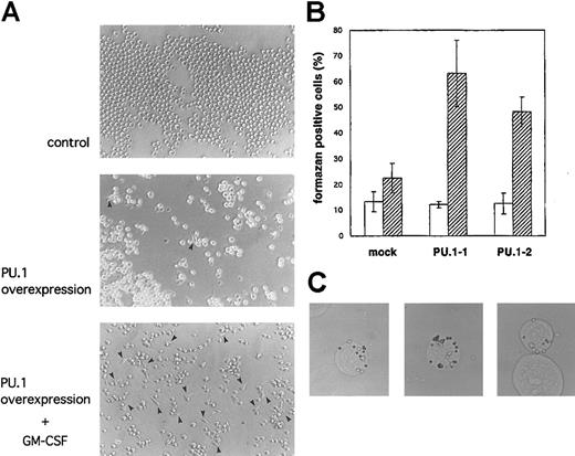 Fig. 4. Induction of morphologic and functional changes in MEL cells after overexpression of PU.1. / (A) PU.1-1 cells cultured for 48 hours without reagents (upper panel), with ZnCl2 (middle panel), or with ZnCl2 and GM-CSF (1 ng/mL; lower panel) are shown. Arrowheads indicate the adherent cells (spindle shape). (B) NBT reduction activity was measured in PU.1-1 cells, PU.1-2 cells, and mock cells cultured for 48 hours with (▨) or without (■) ZnCl2. Data represent the mean ± SD values from 3 independent experiments. (C) PU.1-1 cells were cultured for 48 hours with ZnCl2, and this was followed by incubation with latex beads for 2.5 hours. Experiments were performed in triplicate. Representative cells taking up latex beads after treatment with ZnCl2 are shown.