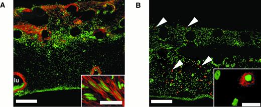 Fig. 4. An array of nonendothelial cell types is present in vascularized collagen implants after incubation on the CAM. / Twenty-micron cryosections through bFGF/VEGF-treated collagen implants were stained using cell type–restricted antibodies (red) and counterstained for nuclei (green). (A) Anti–α-smooth muscle actin stains fibroblastic cells (myofibroblasts) that appear in the upper regions of the implant. Bar indicates 200 μm. Individual myofibroblast-like cells, oriented in parallel, are shown at higher magnification (inset; bar, 10 μm). A large blood vessel lumen (lu) is lined by α-smooth muscle actin-positive cells. (B) Antibody CVI-ChNL-68.1, a marker for chicken macrophages, identifies specific cells that are present throughout the vascularized implant (arrowheads). Bar indicates 200 μm. At higher magnification, these cells are tissue macrophage–like in appearance (inset; bar, 20 μm).