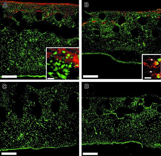 Fig. 6. Multiple MMPs are present in the collagen implants after incubation on the CAM. / Embryos containing the collagen implants were incubated for 66 hours before harvesting. Twenty-micron cryosections through bFGF/VEGF-treated collagen implants were stained using affinity-purified MMP-specific antibodies (red) and counterstained for nuclei (green). (A) Chicken MMP-2 appears in a pericellular pattern within the extracellular matrix. Bar indicates 200 μm. Inset, bar indicates 20 μm. (B) The chicken MMP-9–like enzyme is associated with both PMNs and the extracellular matrix. Bar indicates 200 μm. In the inset, individual positively stained PMNs are enmeshed in a positively staining matrix (asterisks). Bar indicates 10 μm. The affinity-purified polyclonal antibodies were subjected to immunodepletion using purified antigens prior to staining to demonstrate the specificity of the MMP-2 (C) or MMP-9 (D) signals. For depletion of antibodies, purified MMP-2, or MMP-9, was electrophoresed and transferred to nitrocellulose. The nitrocellulose strips were blocked with serum and incubated overnight with dilute solutions of affinity-purified anti–MMP-2 or anti–MMP-9 antibody. The adsorbed antibody solutions were used for immunostaining and yielded no signal (C, D).